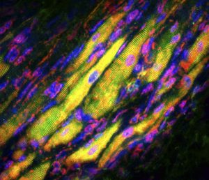 These are induced cardiomyocytes (iCMs) that Li Qian's lab produced in experiments turning scar tissue into healthy heart muscle.