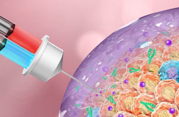 When injected into tumors, this therapy forms a gel to attack cancer cells. (Gu Lab)
