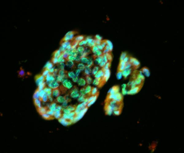 These lung spheroid cells showed powerful regenerative properties when applied to a mouse model of lung fibrosis. (Cheng Lab)