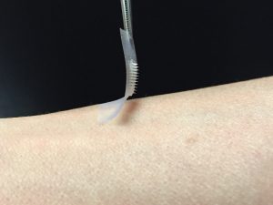 The smart insulin patch could be placed anywhere on the body to detect increases in blood sugar and then secrete doses of insulin when needed. (Courtesy of Zhen Gu, PhD)