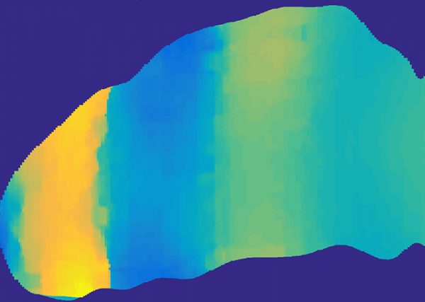 This is a velocity map of the brain. The transitions between blue and yellow indicate a shock front.